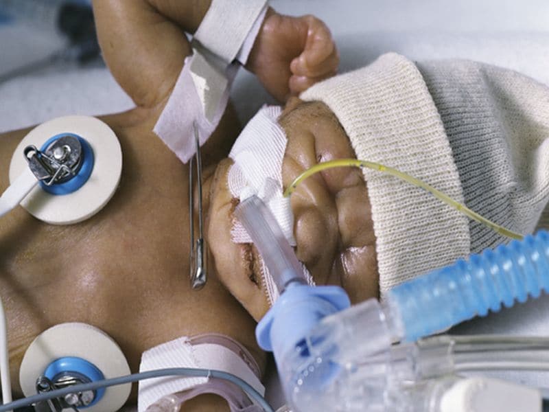 QI Program Can Up Outcomes for Neonatal Abstinence Syndrome