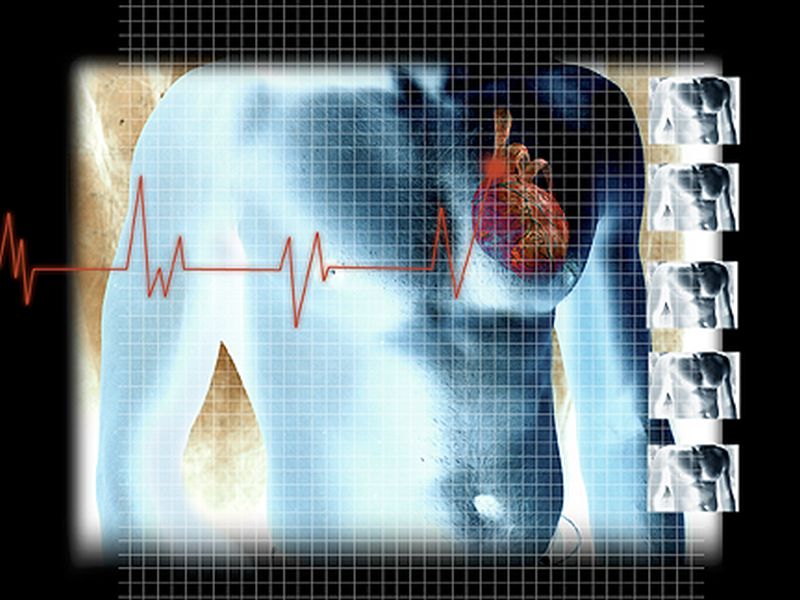 2D and 3D MRI Techniques Similar for Cardiac Measures