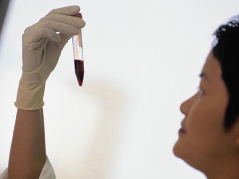Blood Test Found to Detect Eight Common Cancer Types