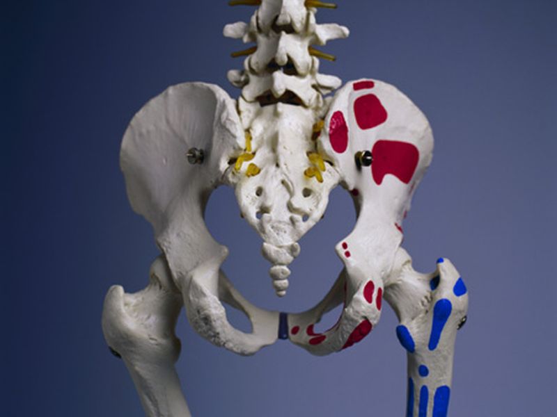 Much Hip Fx Variation in Nursing Homes Remains Unexplained