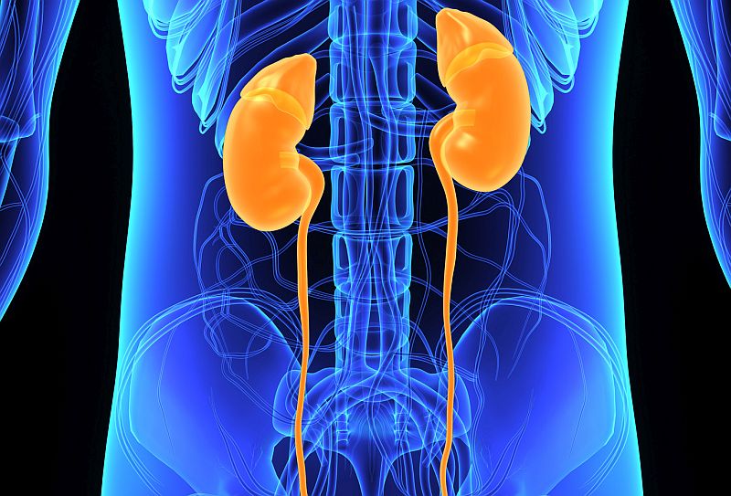 Multigene Panel Tests Can ID Hereditary Kidney Cancer