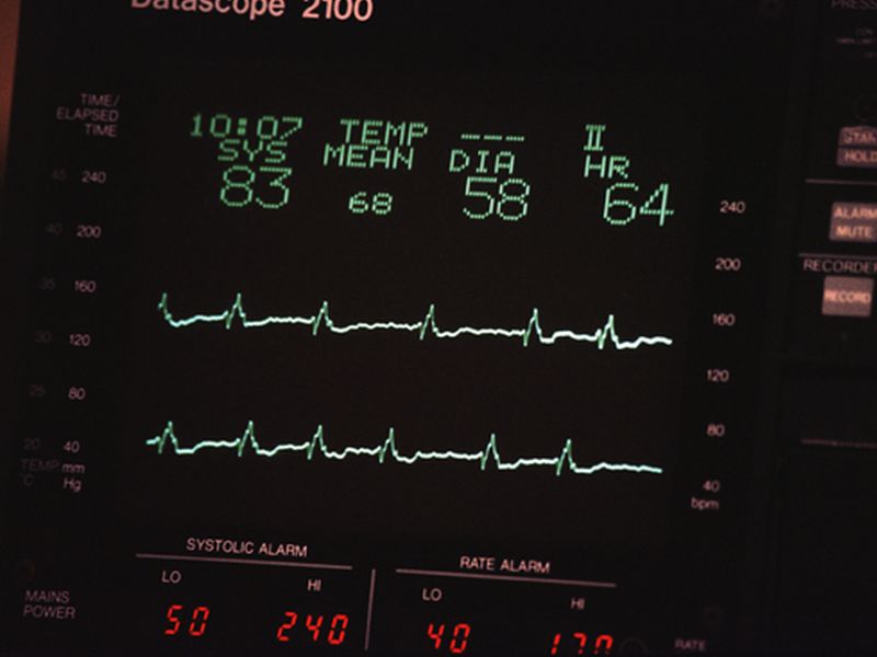 Most ICU Patient Alarms Not Clinically Accurate or Relevant