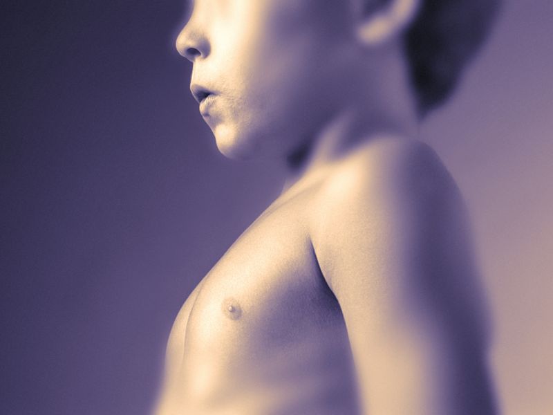 Socioeconomic Position Tied to Carotid Wall Thickness in Kids