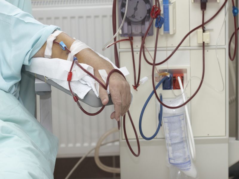FDA Permits Marketing of Devices to Create Arteriovenous Fistula
