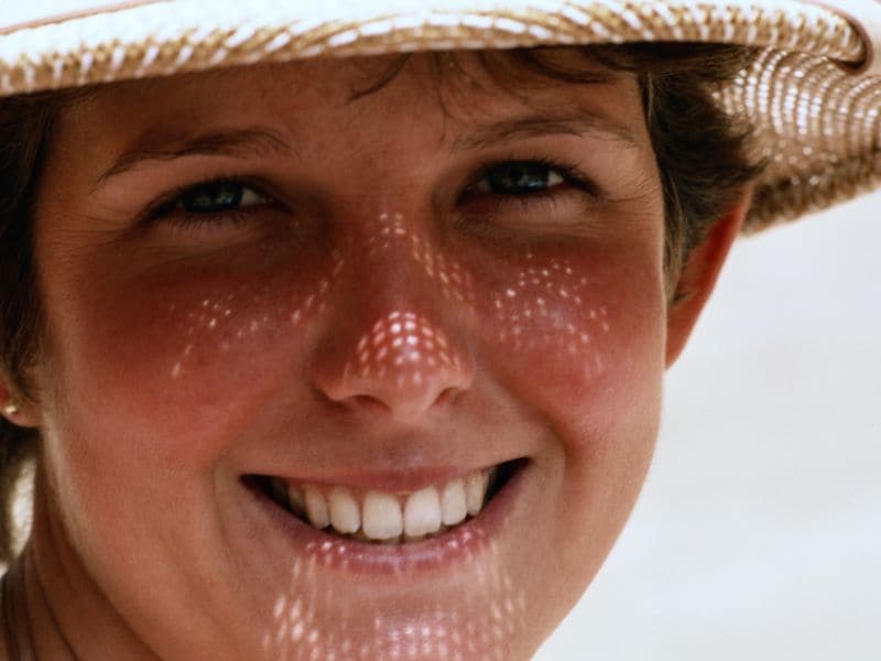 Dermatologist Intervention Tied to Better Sun Protection