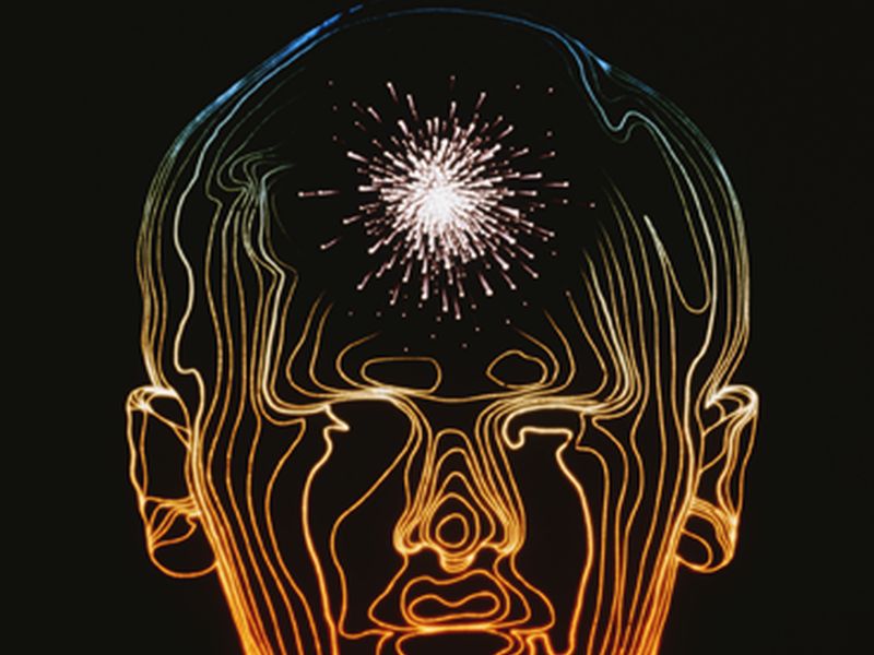 New Risk Score Assesses Stroke Risk After MI Without A-Fib