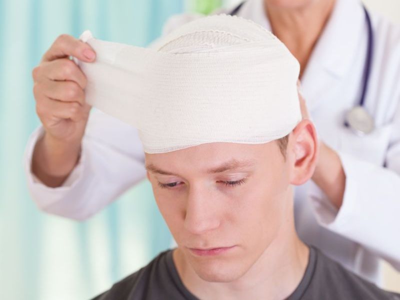 Concussion May Increase Multiple Sclerosis Risk
